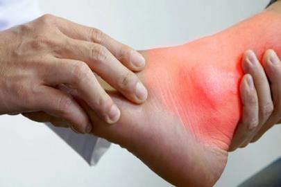 Sessiz Tehdit: Gut Hastalığı Eklem Sağlığını Nasıl Bozuyor?